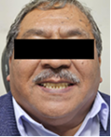 Fotos de resultado final