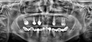 Radiografía panorámica