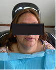 Fotos de resultado final