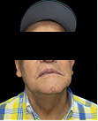 Fotos de resultado final