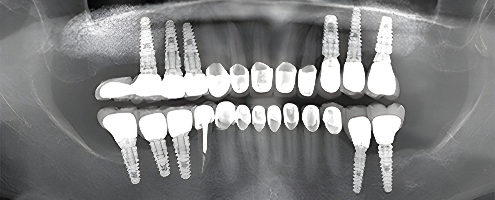 Odontonova Centro de Implantología