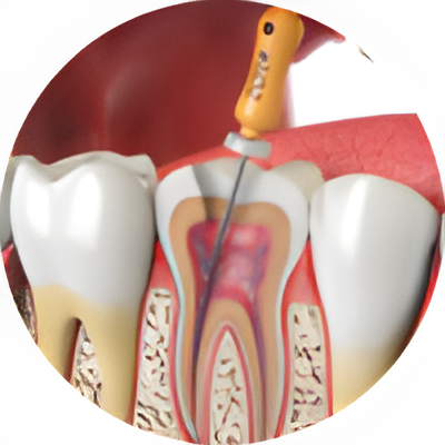 Endodoncia