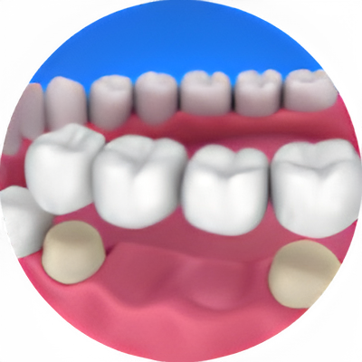 Rehabilitacion Oral